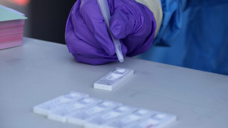 EK doporučila státům EU využívat rychlotesty na covid-19 při cestování či plošném testování